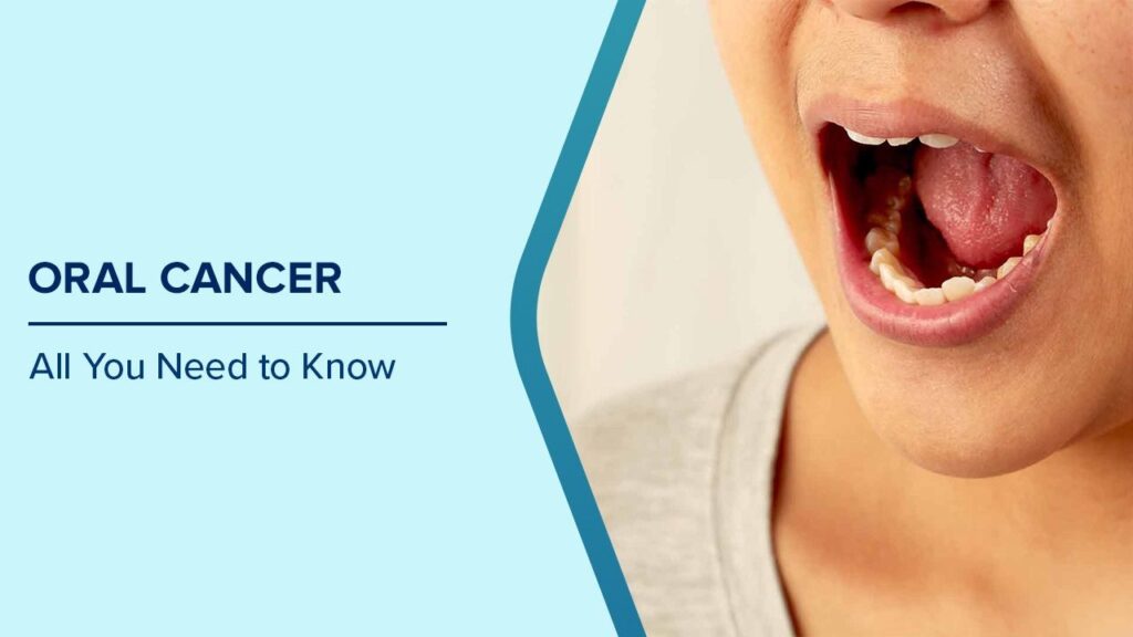 oral cancer
